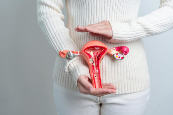 Chist ovarian