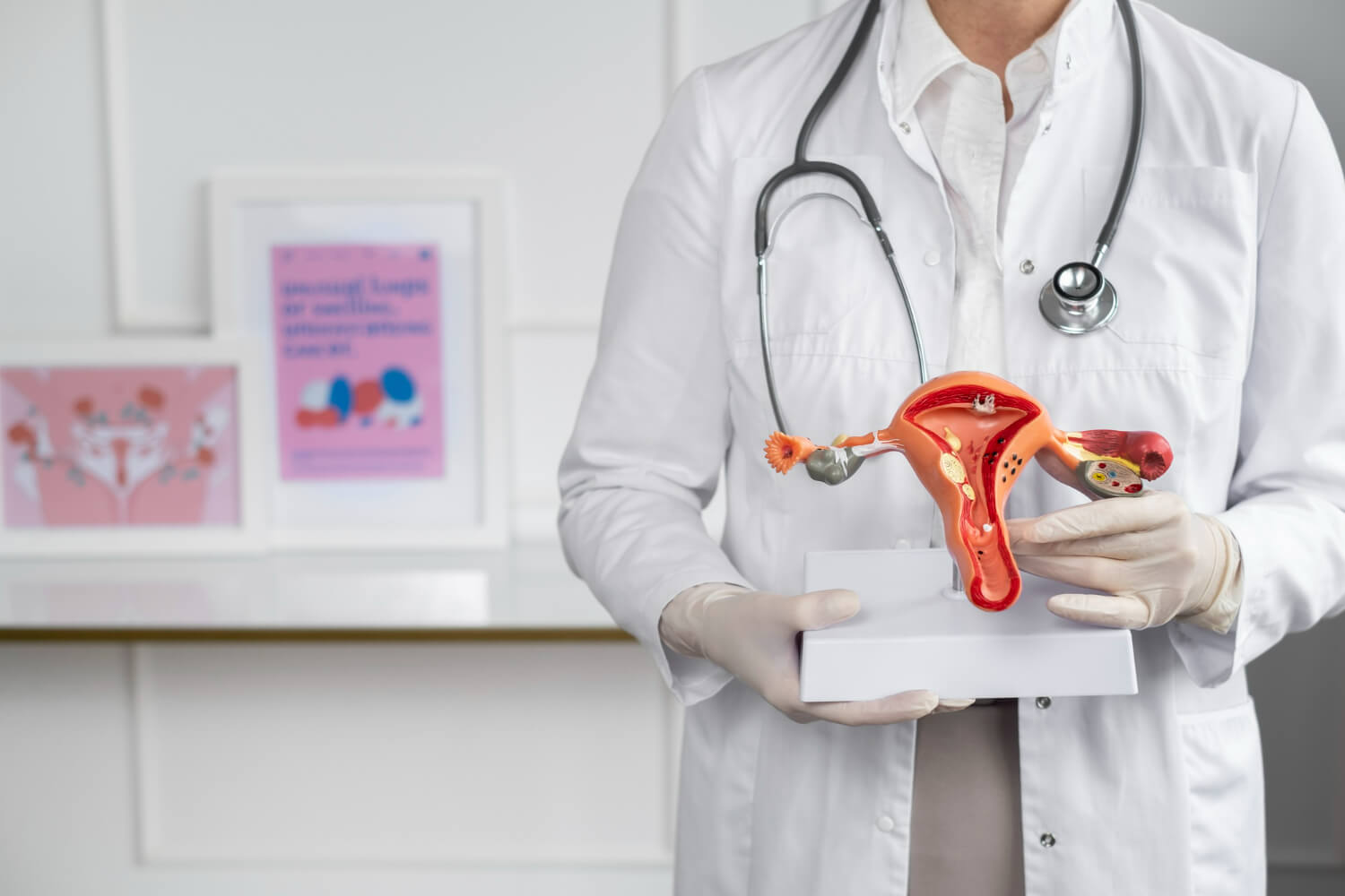 Tratament cancer col uterin Tratament cancer col uterin