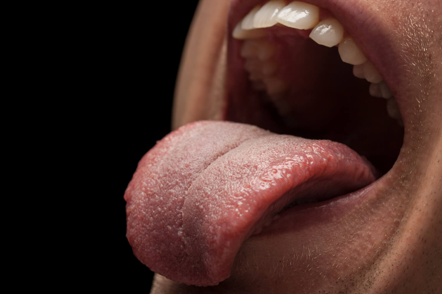 Cancer oral cauze Cancer oral cauze
